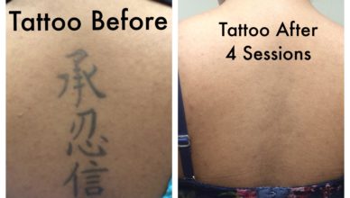 Looking For Tattoo Removal: Know The Cost